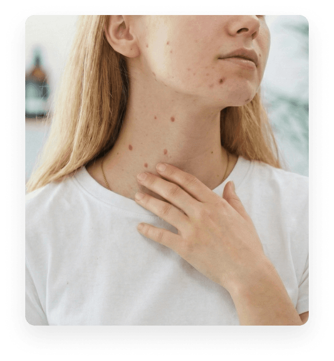 Dermatologas dermatoskopu tiria paciento kaklo apgamus